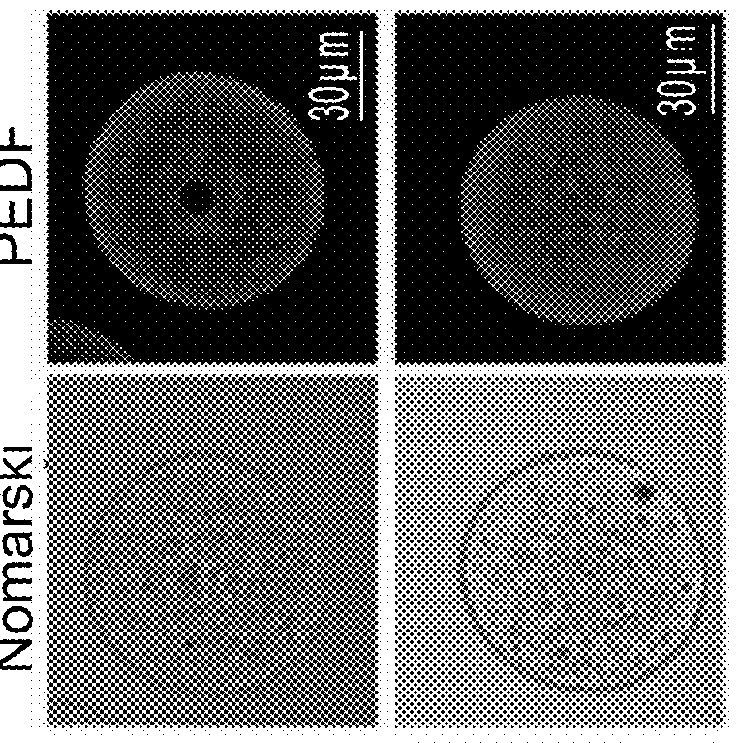 Compositions comprising pedf and uses of same in the treatment and prevention of ovary-related syndromes