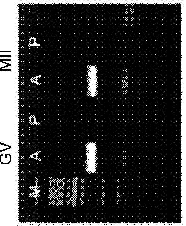 Compositions comprising pedf and uses of same in the treatment and prevention of ovary-related syndromes