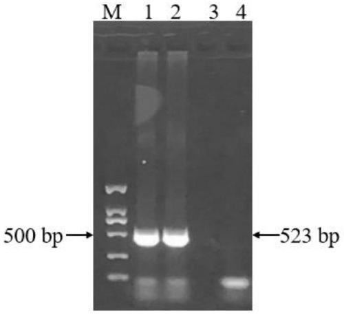 Primer group for nest type RT-PCR detection of seneca valley virus (SVV), kit and application