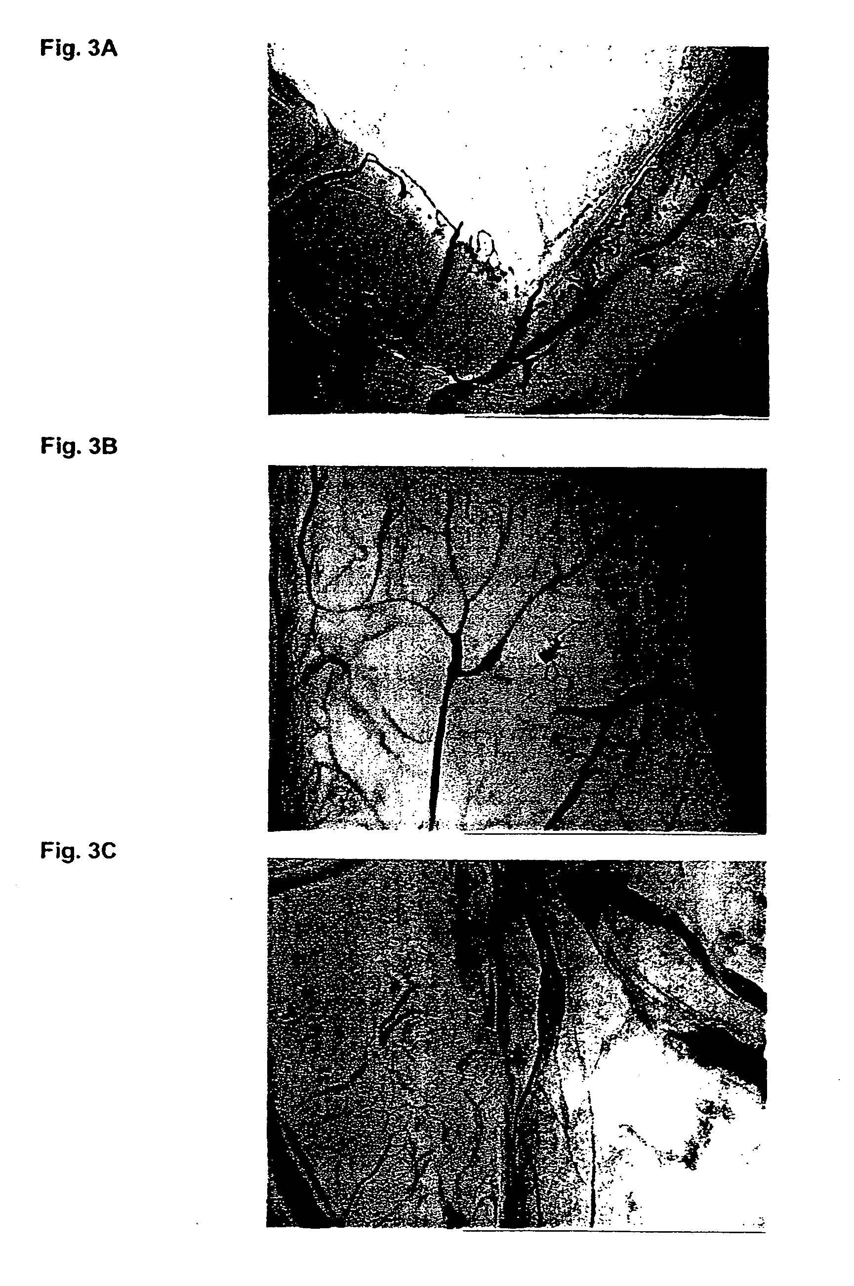 Anticancer peptide compositions