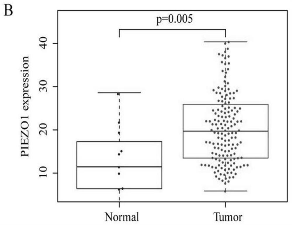 application of PIEZO1 protein as esophageal cancer marker