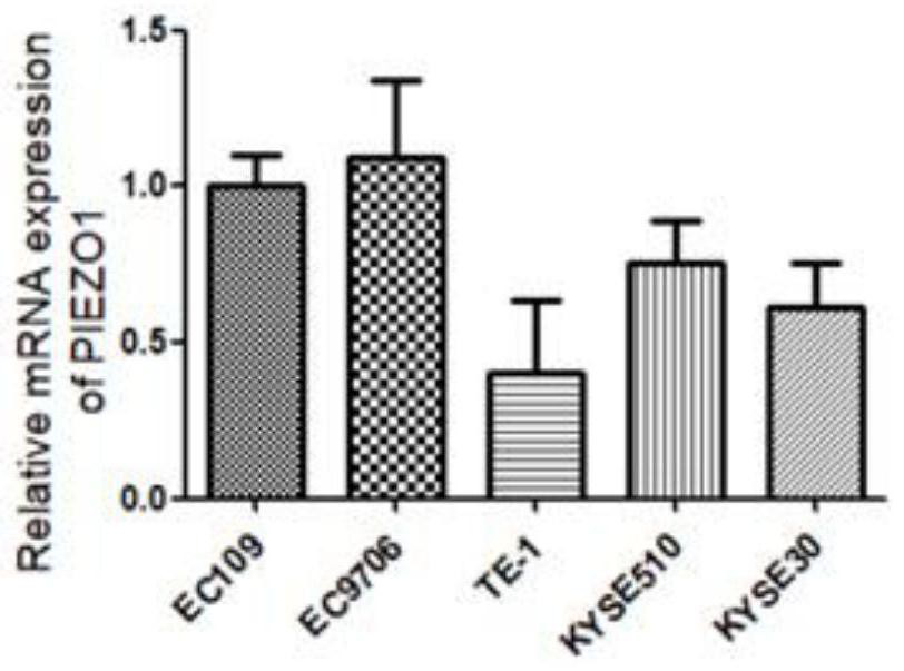 application of PIEZO1 protein as esophageal cancer marker