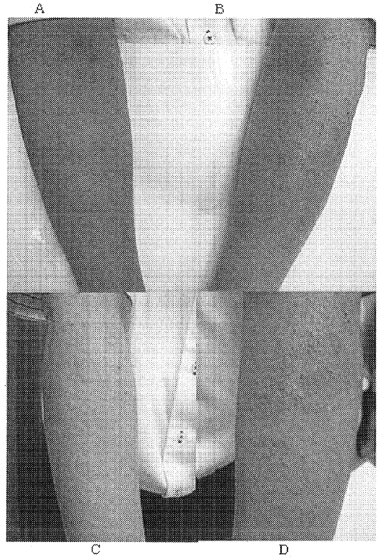 Method for treating dermatitis and improving skin texture using natriuretic peptides