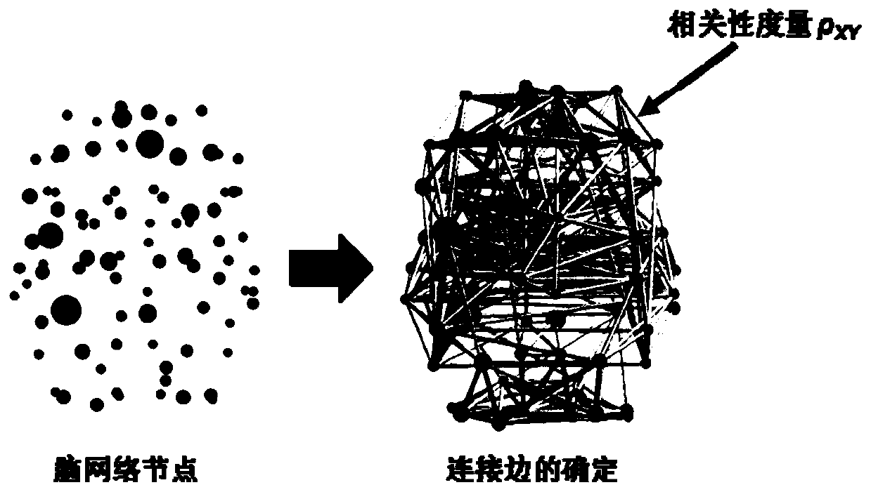 Brain network specific structure extraction method for Alzheimer's disease and mild cognitive impairment