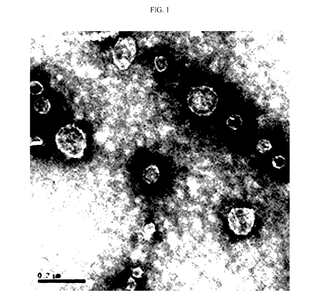 Composition for treating or preventing metabolic disease, containing, as active ingredient, extracellular vesicles derived from akkermansia muciniphila bacteria