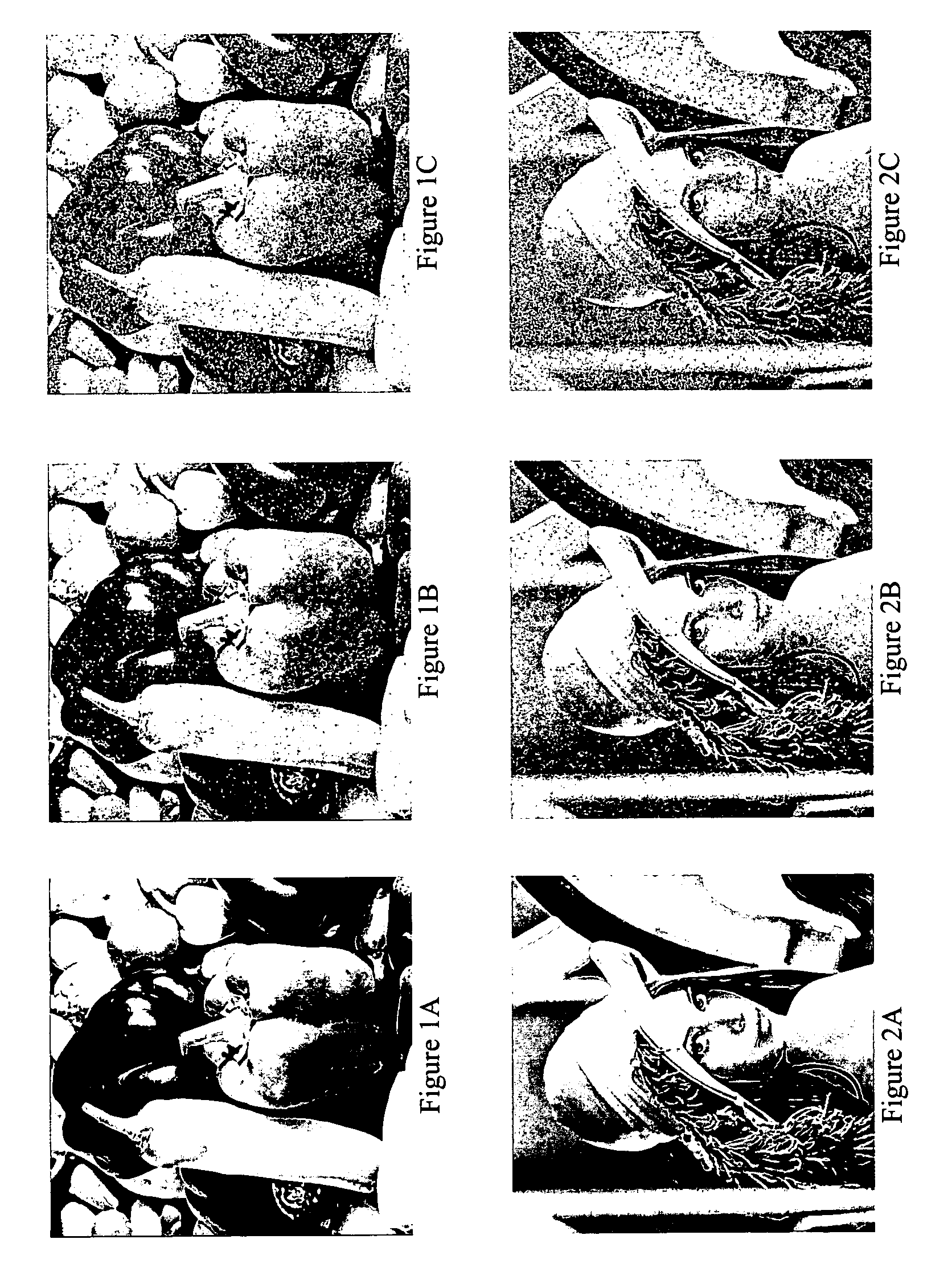 Image denoising based on wavelets and multifractals for singularity detection and multiscale anisotropic diffusion