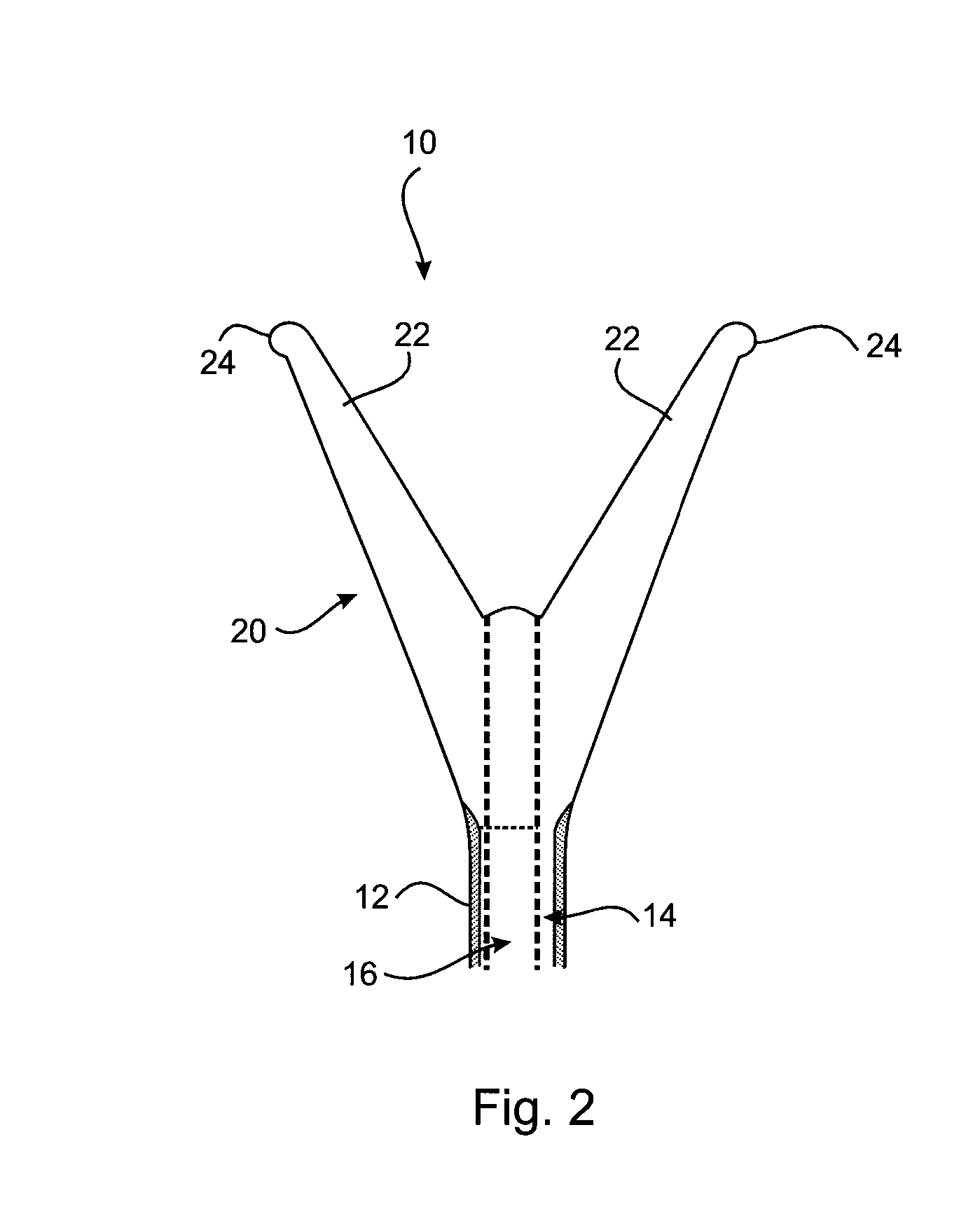 Therapeutic substance transfer catheter and method