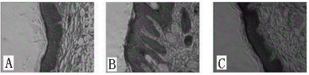 Nitidine chloride, derivative thereof, and applications of nitidine chloride and derivative of nitidine chloride in preparing medicines used for preventing and treating dermatosis