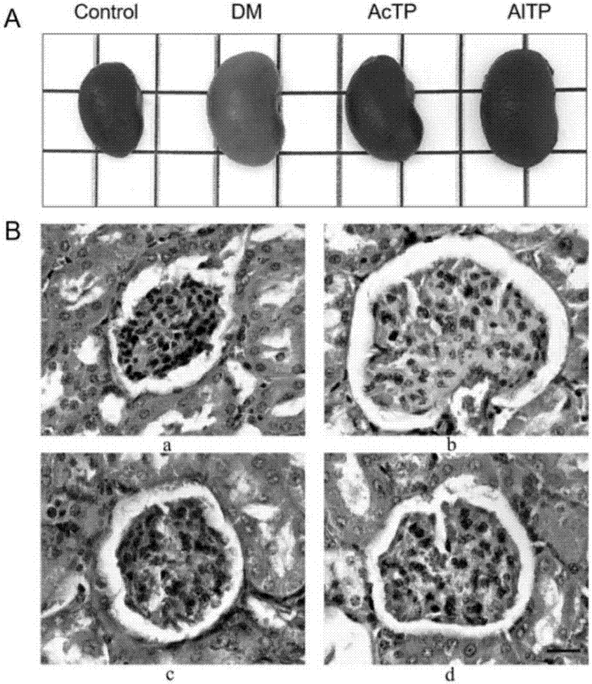 Application of tea peptides to relieving diabetic nephropathy