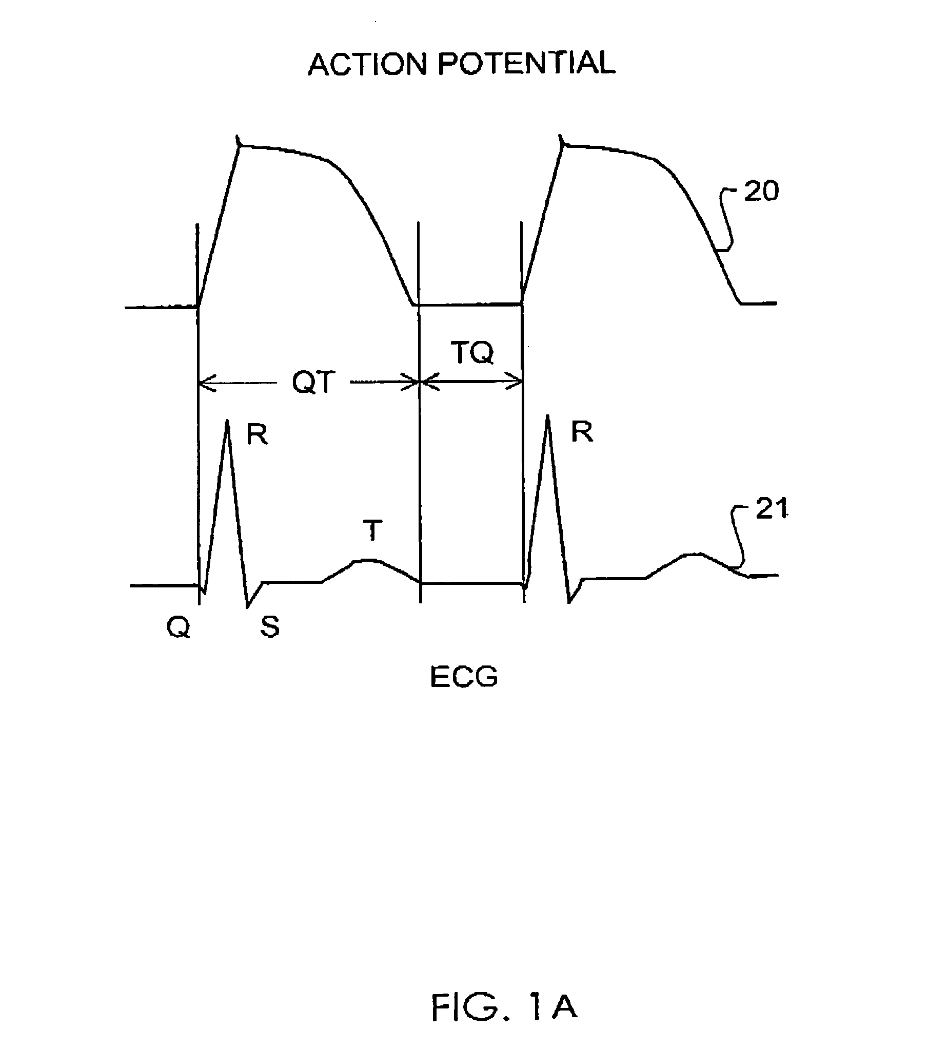 Method and system for evaluating arrhythmia risk with QT-RR interval data sets