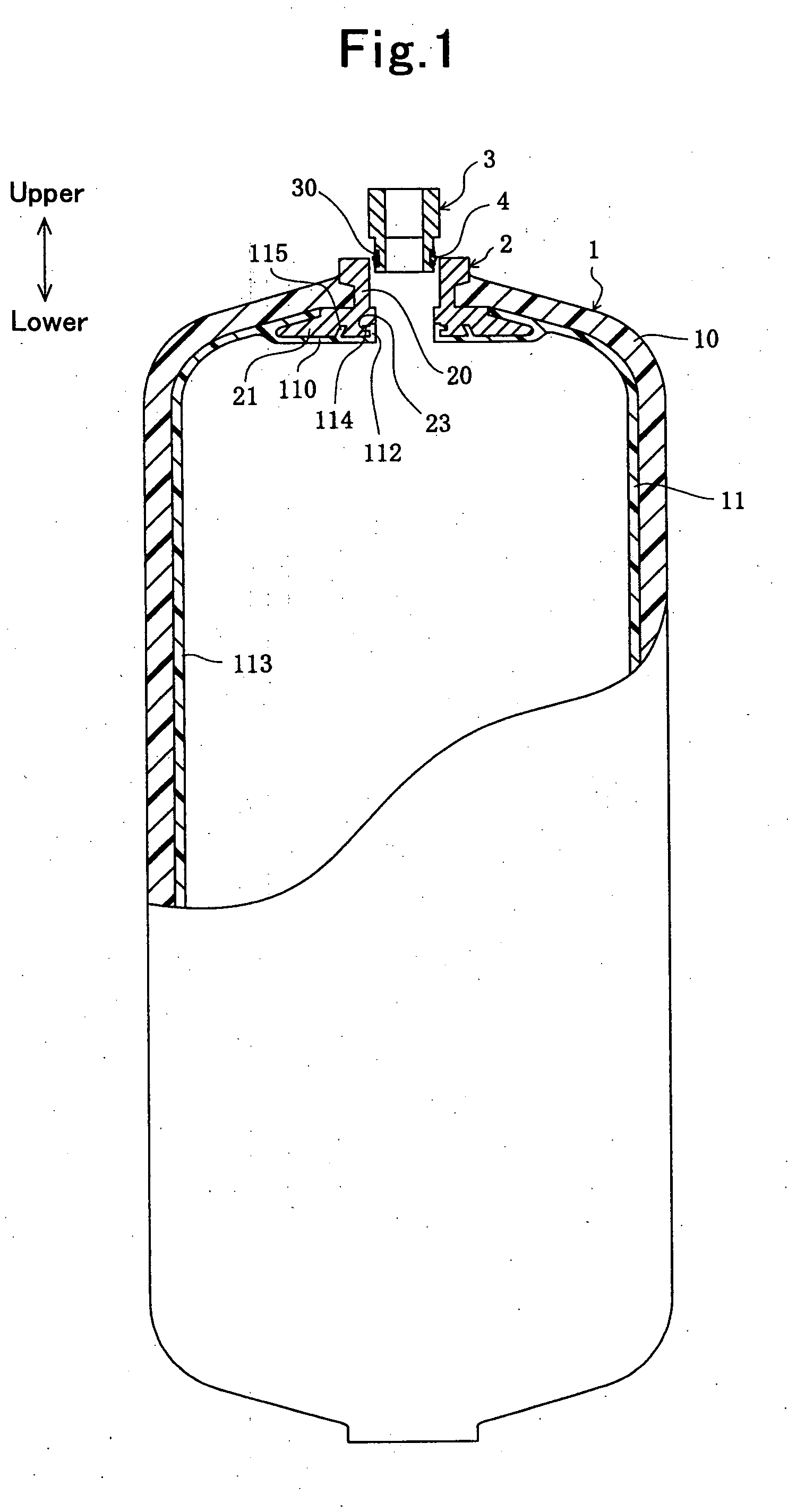 Pressure vessel