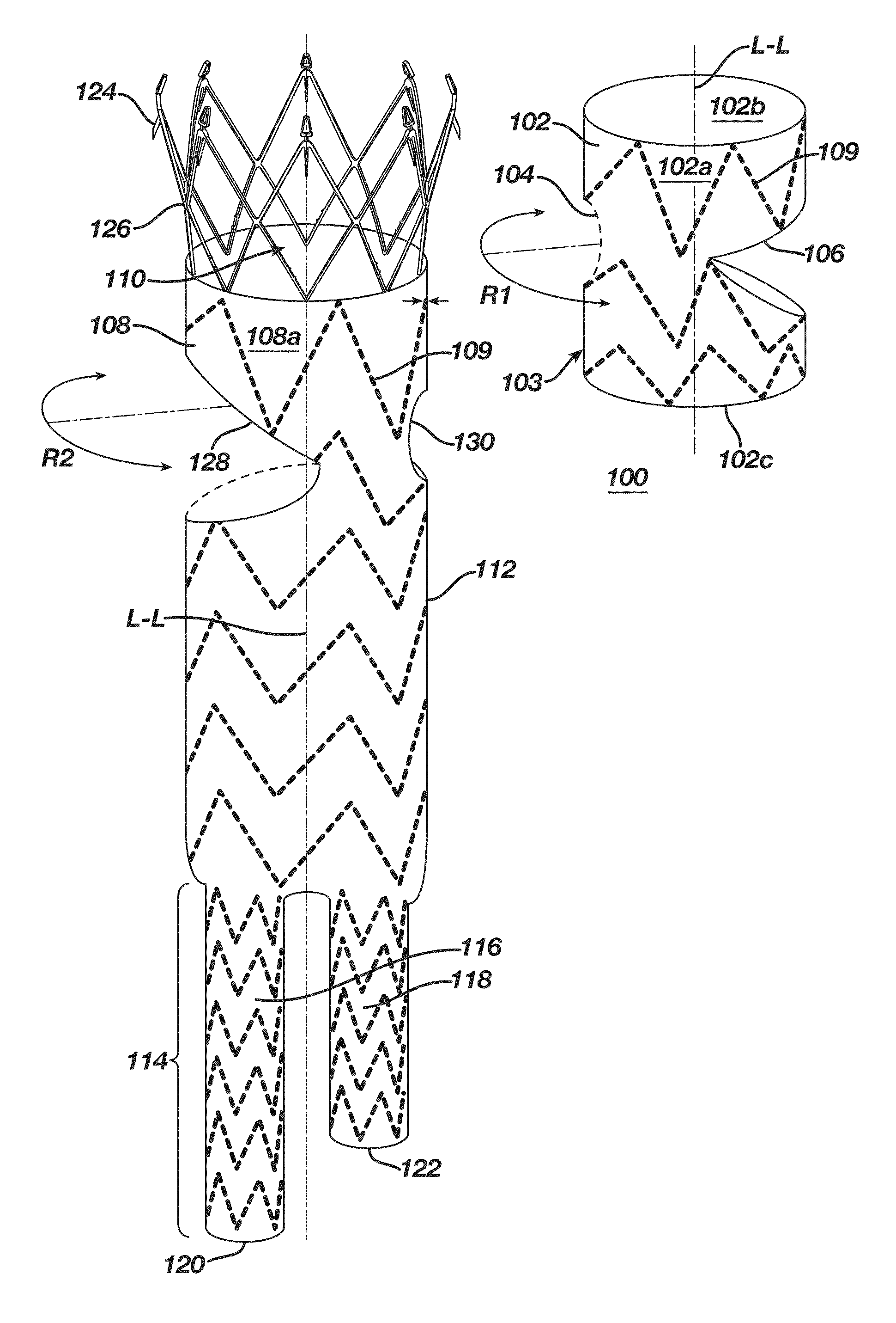 Circular Sectional Inserts For Insertion with a Trunk Section in Endoprosthesis for Aortic Aneurysm