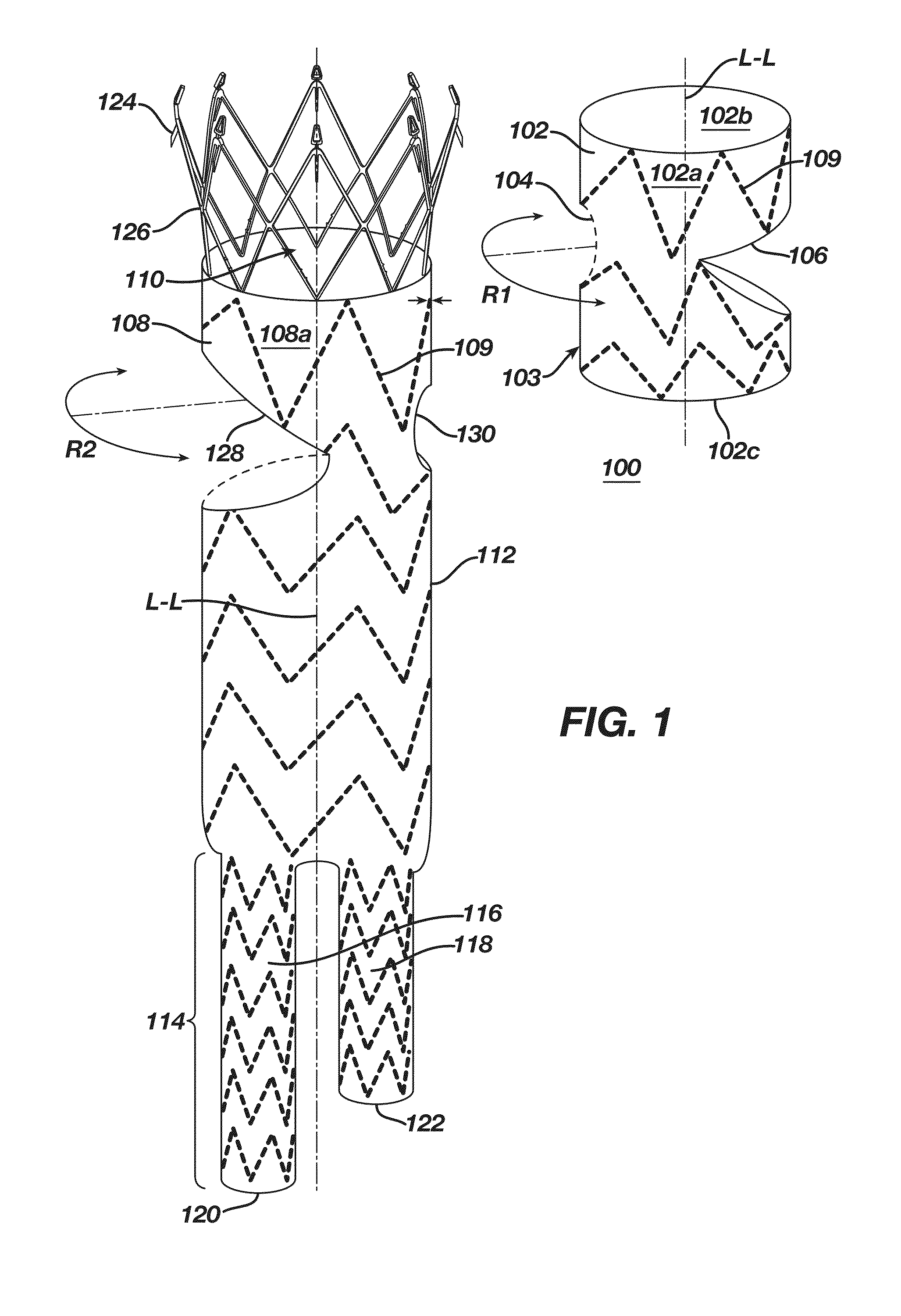 Circular Sectional Inserts For Insertion with a Trunk Section in Endoprosthesis for Aortic Aneurysm