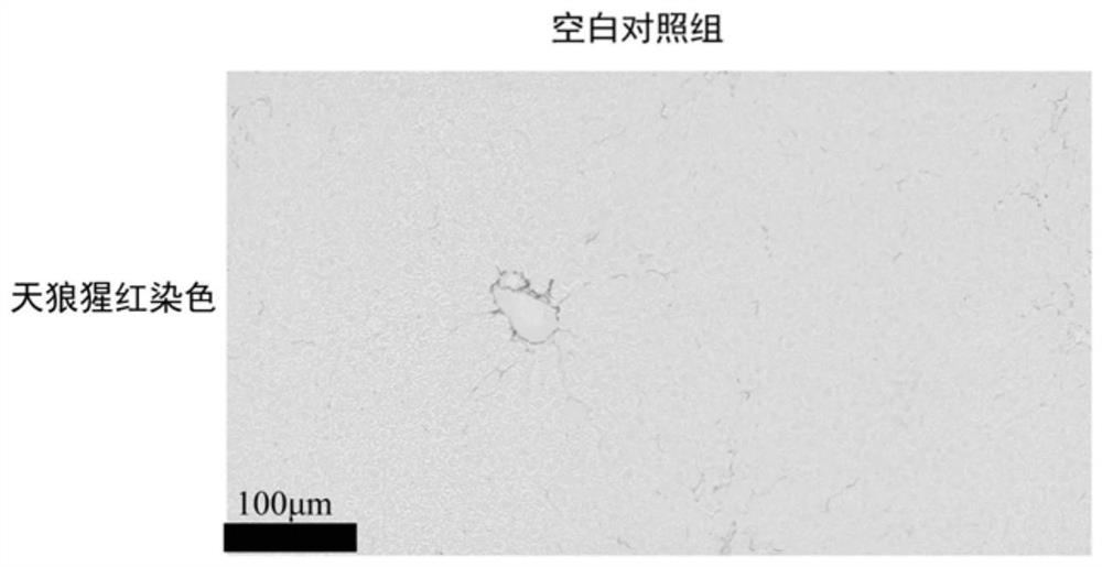 A kind of anti-hepatic fibrosis composition and its application