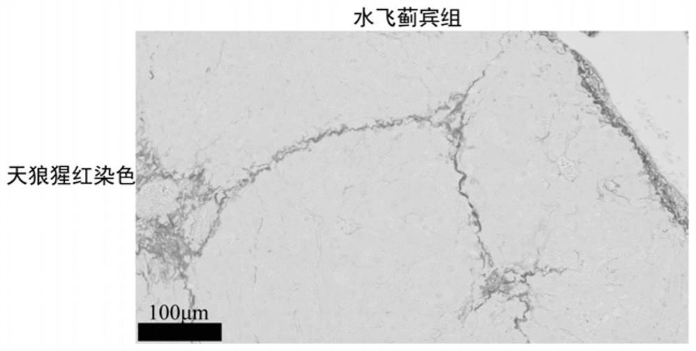 A kind of anti-hepatic fibrosis composition and its application