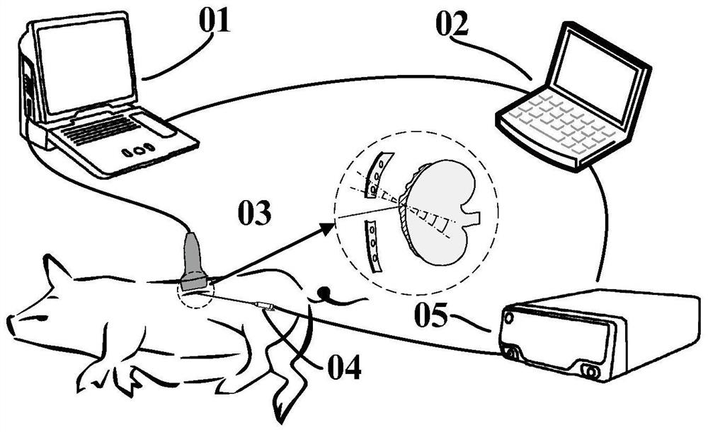 Method and device for estimating in-vivo heat source distribution based on ultrasonic imaging