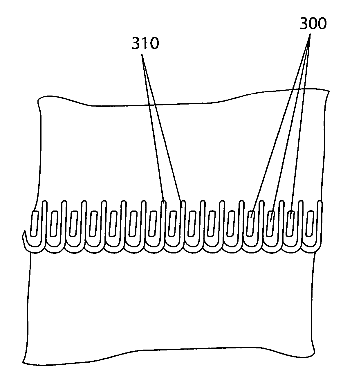 Method and device for stabilizing unseamed loops