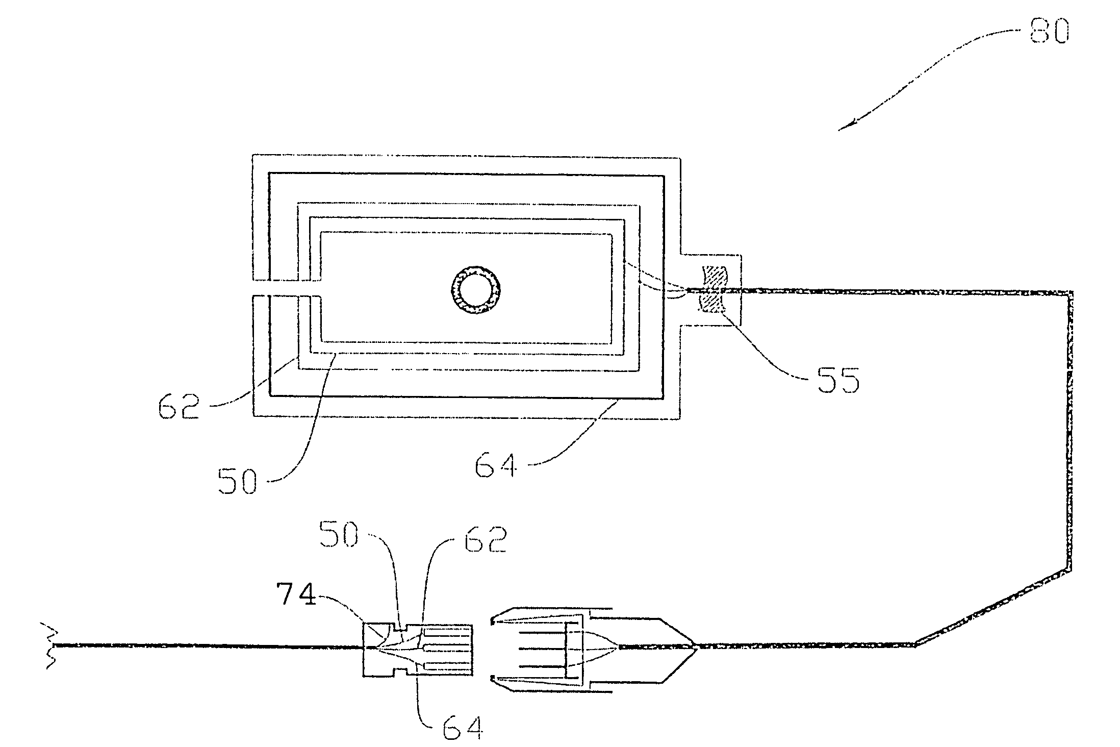 Dressing and integrated system for detection of fluid loss
