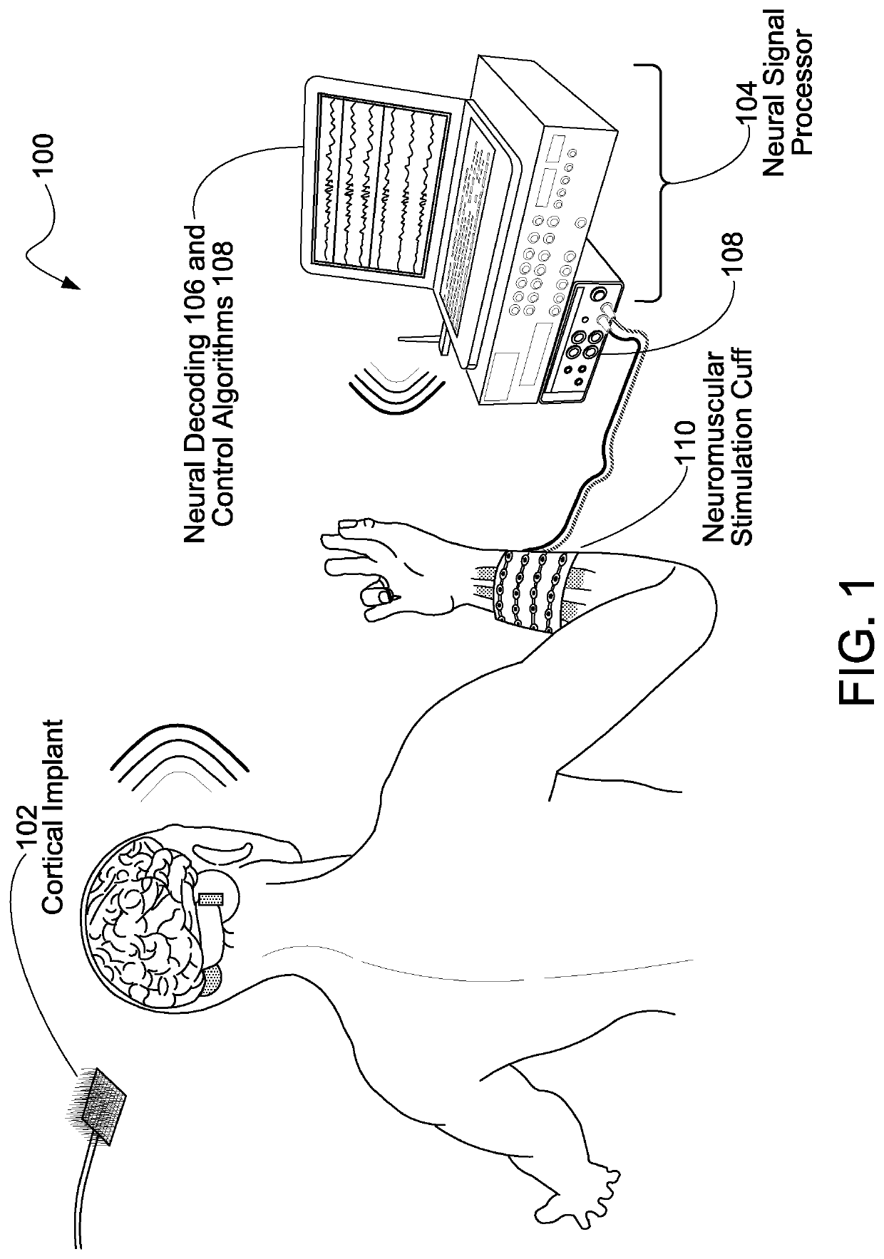 Neural sleeve for neuromuscular stimulation, sensing and recording