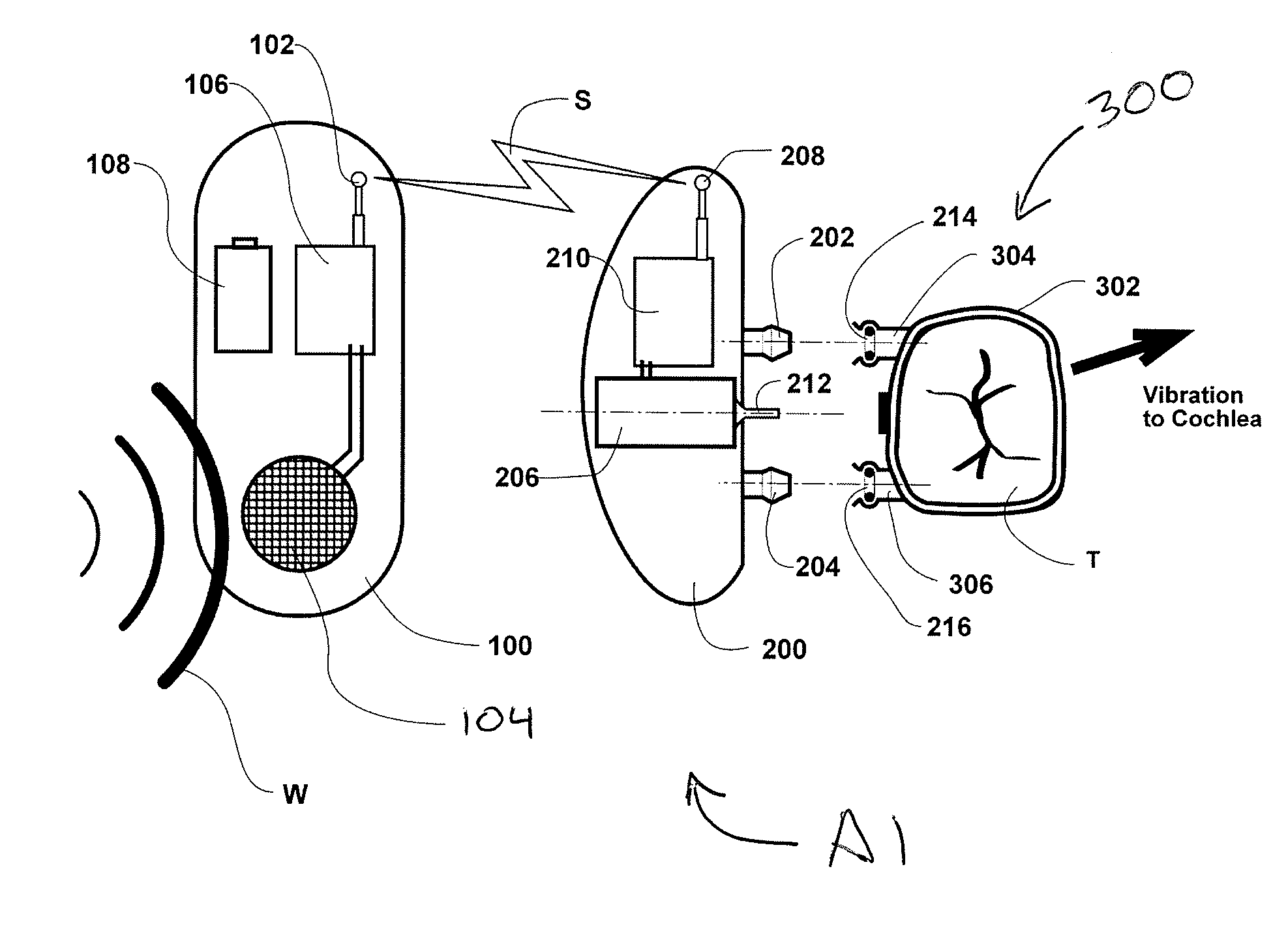 Hearing Aid Apparatus and Method