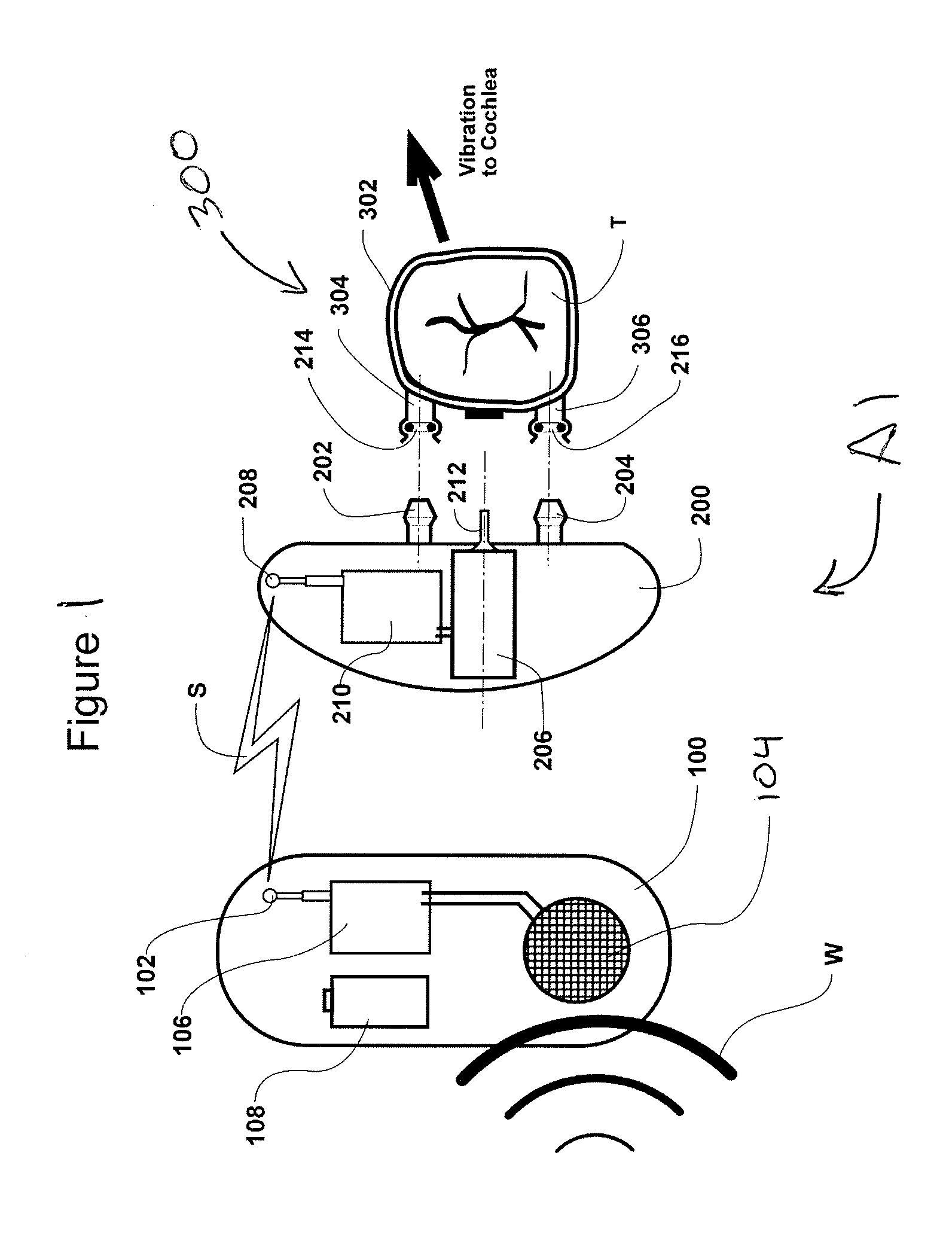 Hearing Aid Apparatus and Method