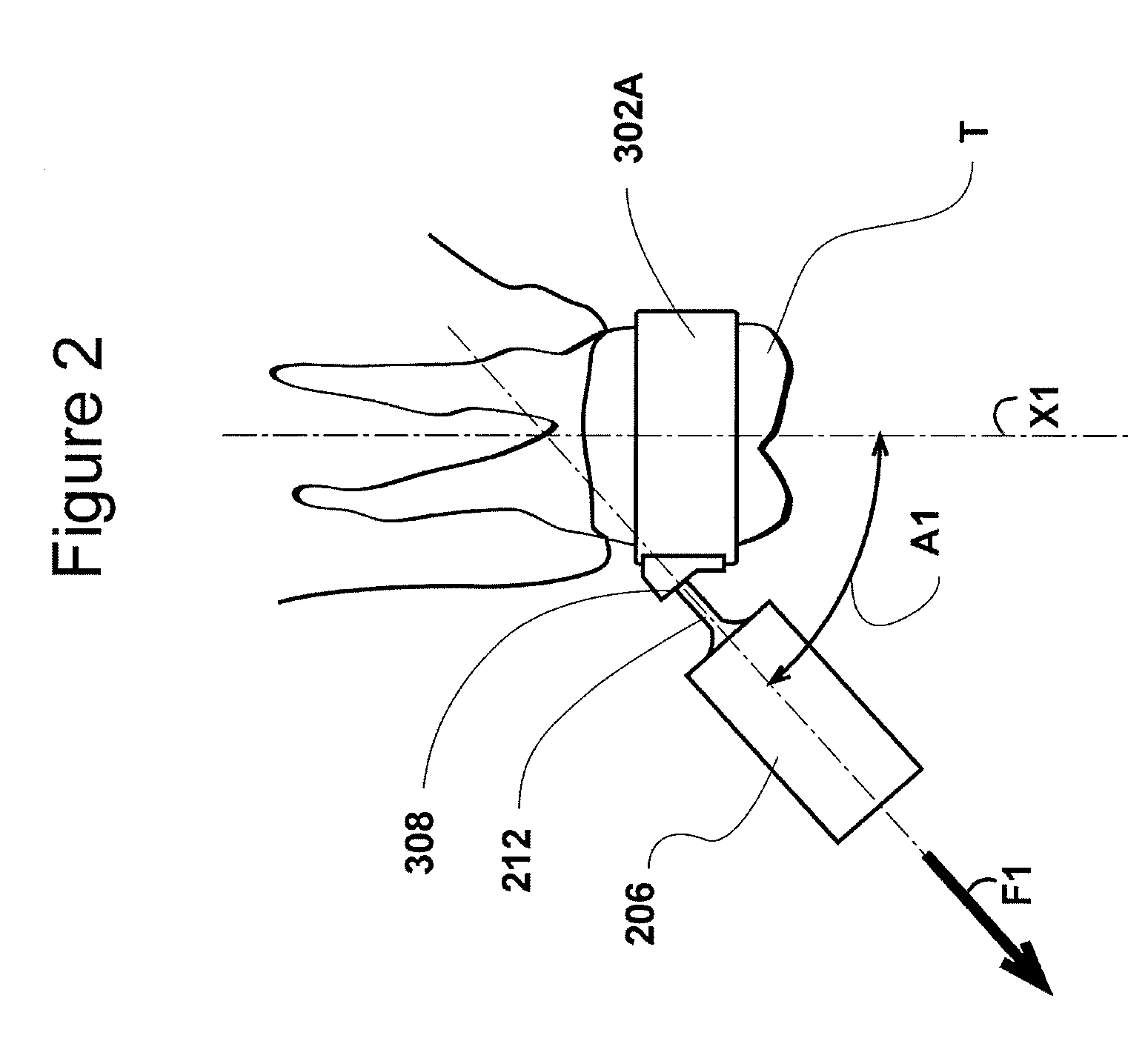 Hearing Aid Apparatus and Method