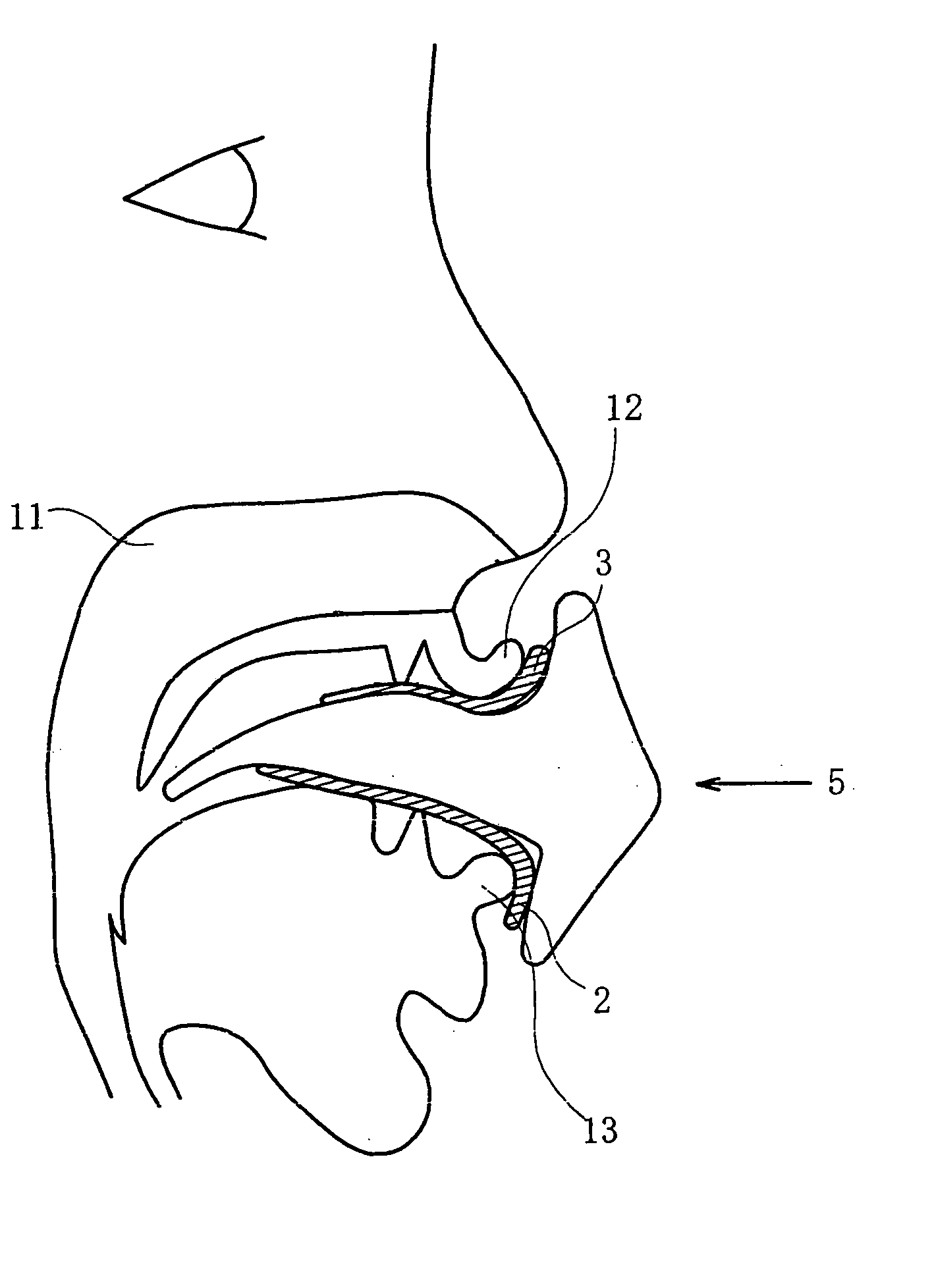 Airway