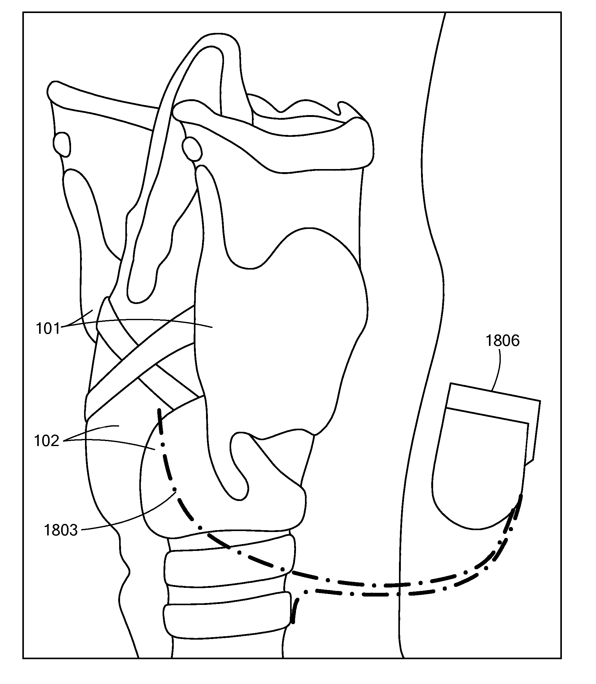 System, Apparatus, and Method for Facilitating Interface with Laryngeal Structures