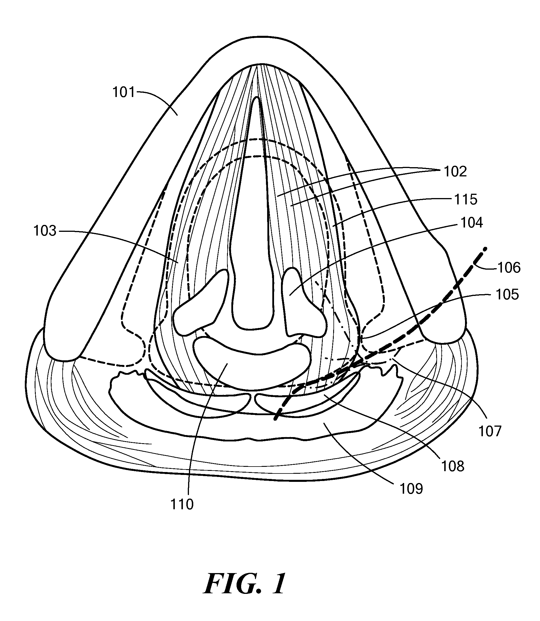 System, Apparatus, and Method for Facilitating Interface with Laryngeal Structures