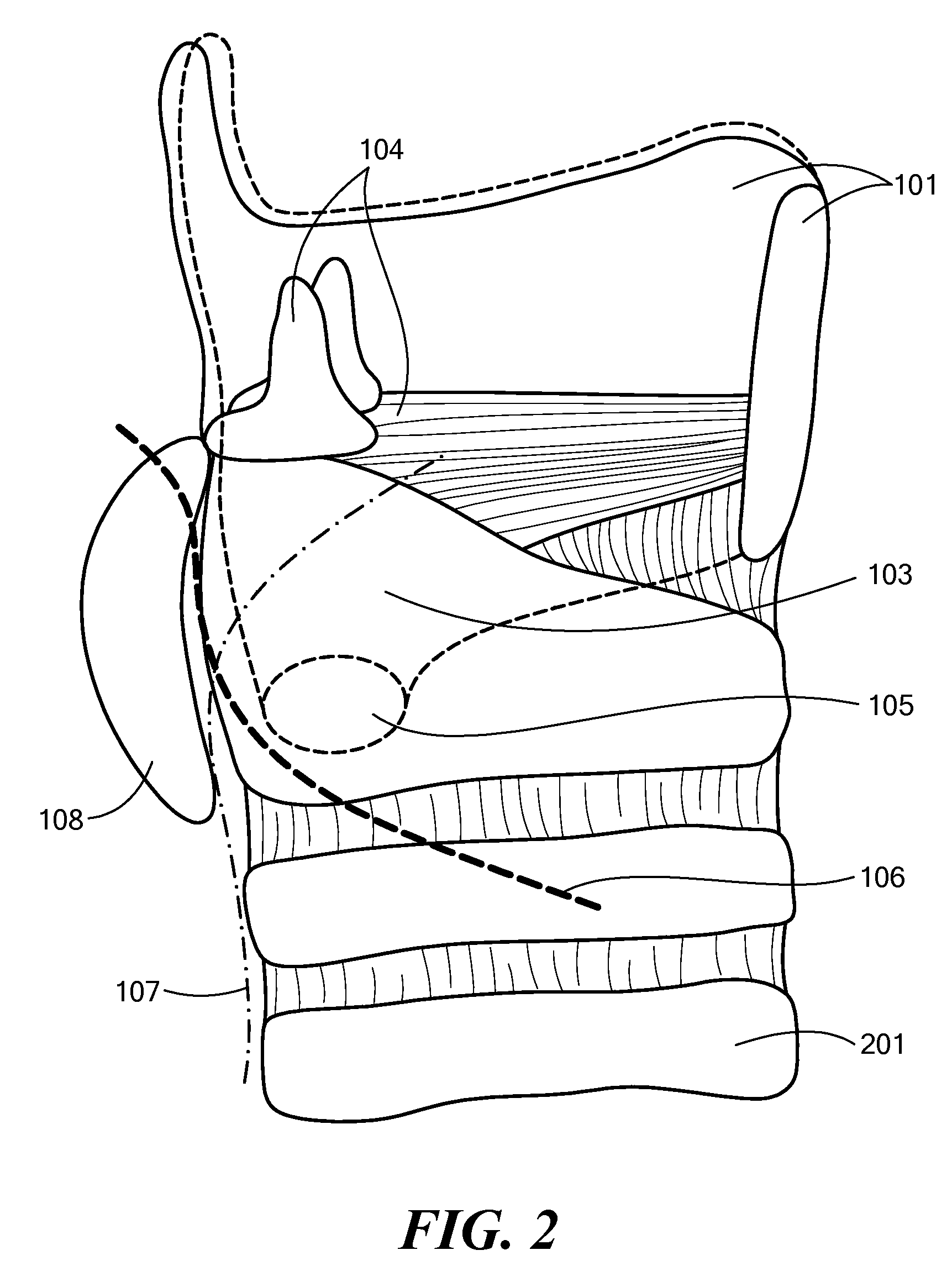 System, Apparatus, and Method for Facilitating Interface with Laryngeal Structures