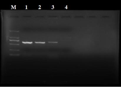 Borrelia burgdorferi detection kit and application thereof