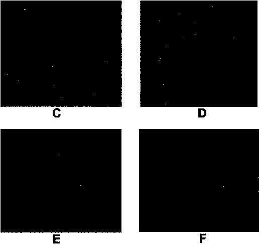 Serum-free fibroblast cell culture medium and preparation method thereof