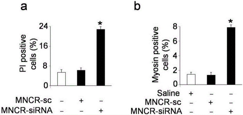 CircRNA MNCR nucleotide, circRNA MNCR nucleotide containing pharmaceutical composition and application thereof