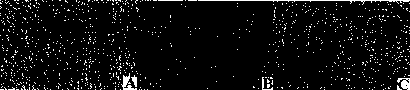 Compound preparation for resisting Parkinson's disease