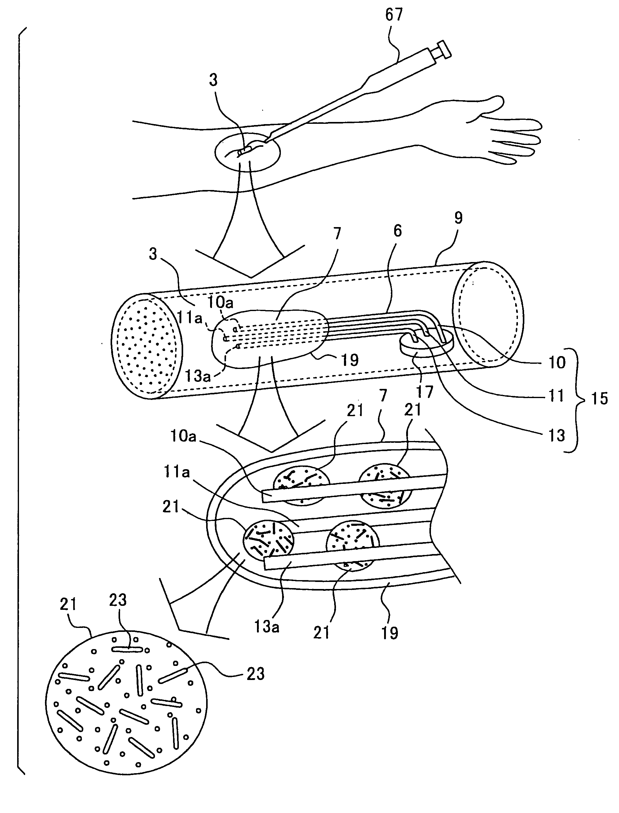 Device and system for humor component detection