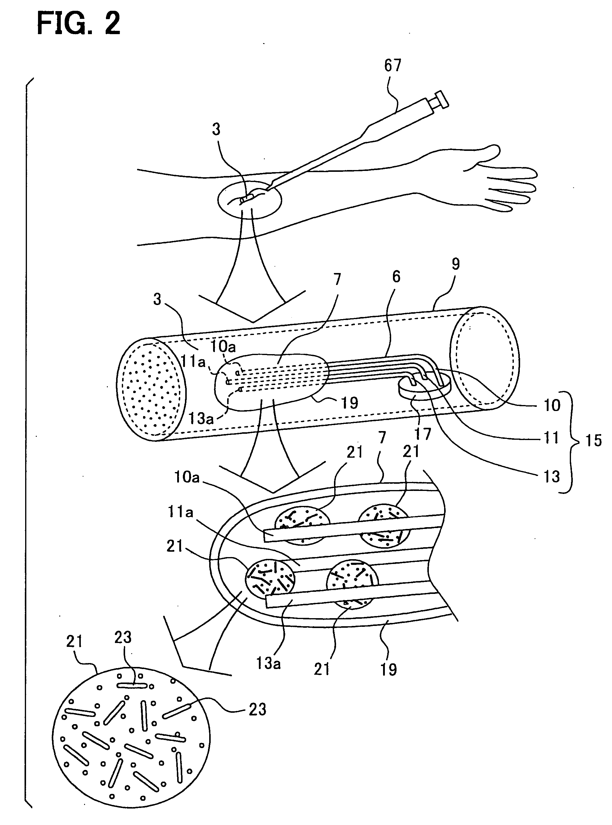 Device and system for humor component detection