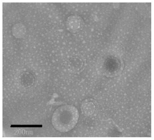 Polymer carrier, preparation method of polymer carrier and anti-tumor nano particle