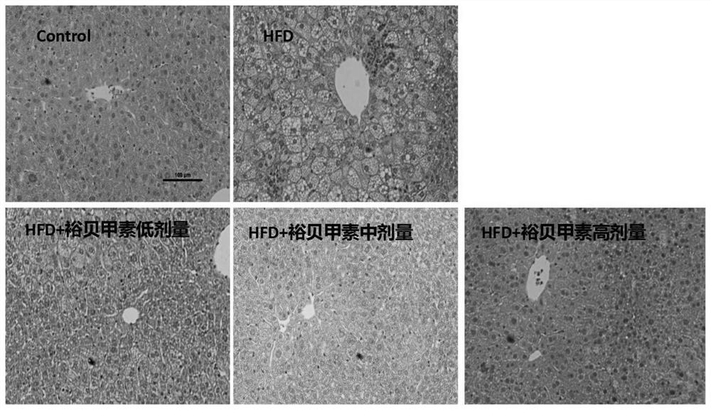 Application of Yubeinine to preparation of medicine for preventing or treating non-alcoholic fatty liver disease