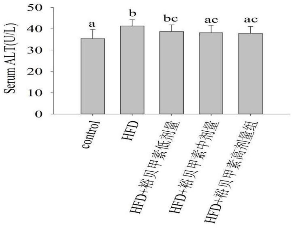 Application of Yubeinine to preparation of medicine for preventing or treating non-alcoholic fatty liver disease