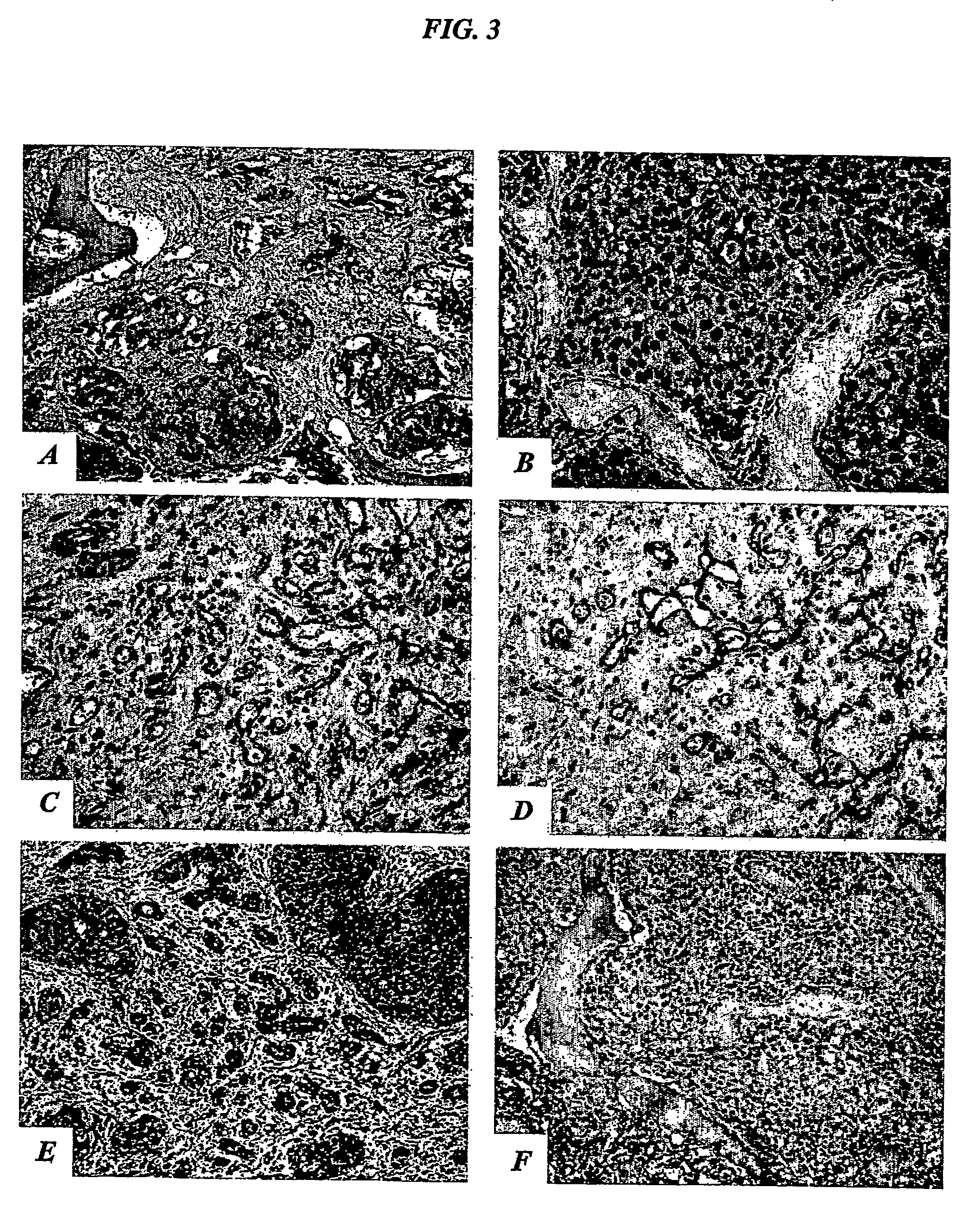 Compositions and methods of use of targeting peptides for diagnosis and therapy of human cancer