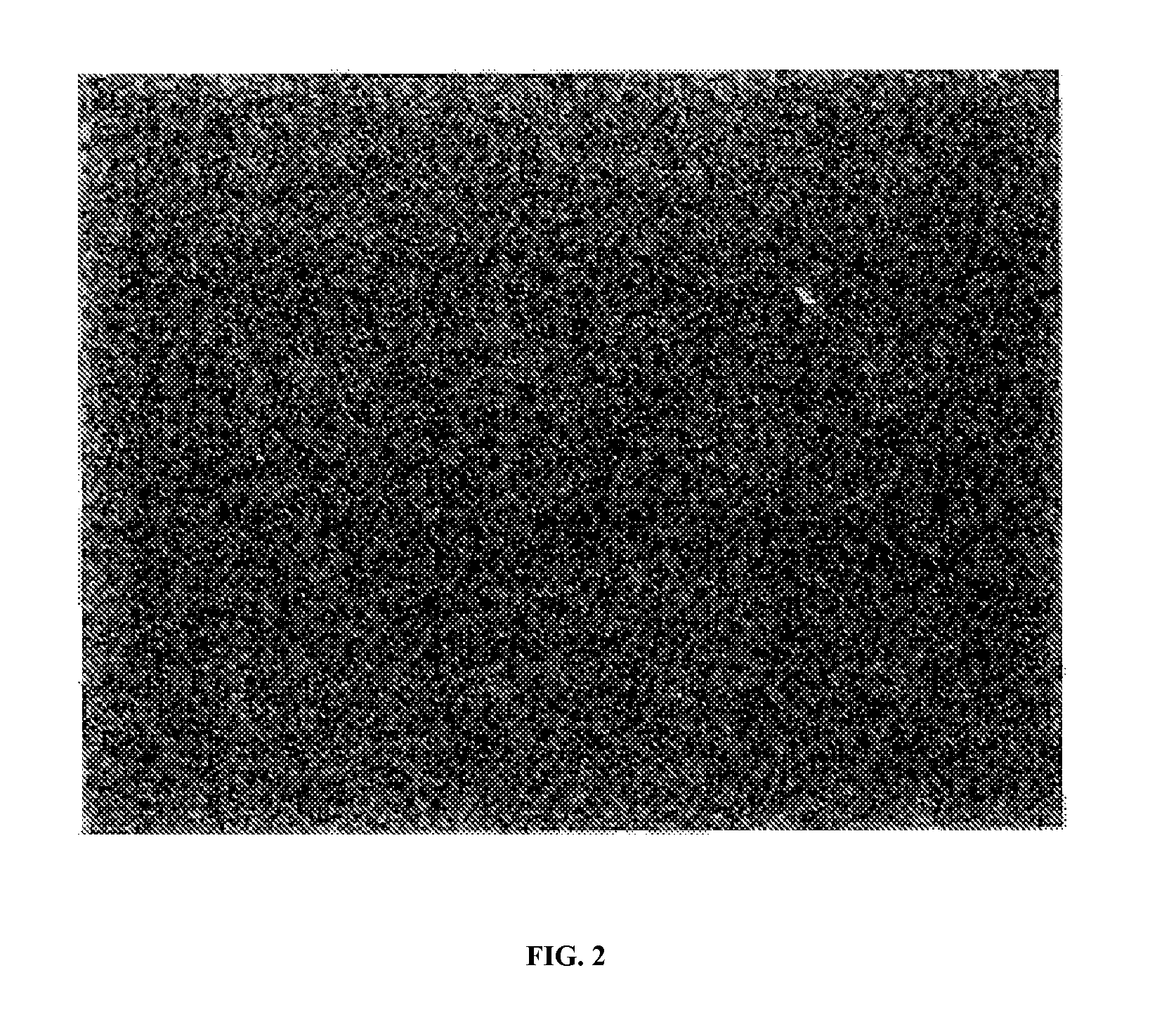 Bank of stem cells for producing cells for transplantation having HLA antigens matching those of transplant recipients, and methods for making and using such a stem cell bank