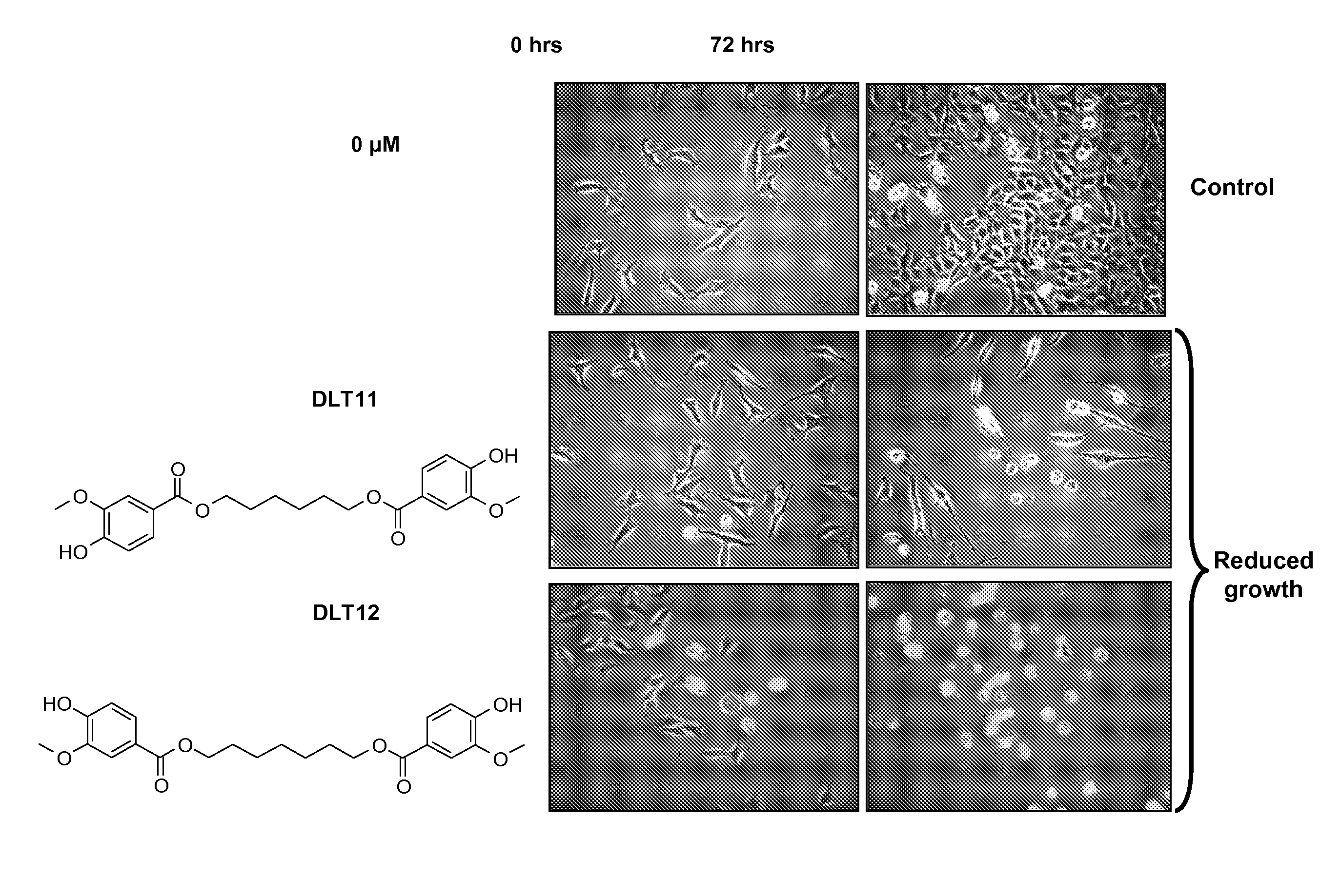 Di-Vanilloyl And Tri-Vanilloyl Derivatives For Use In Anti-Cancer Therapy