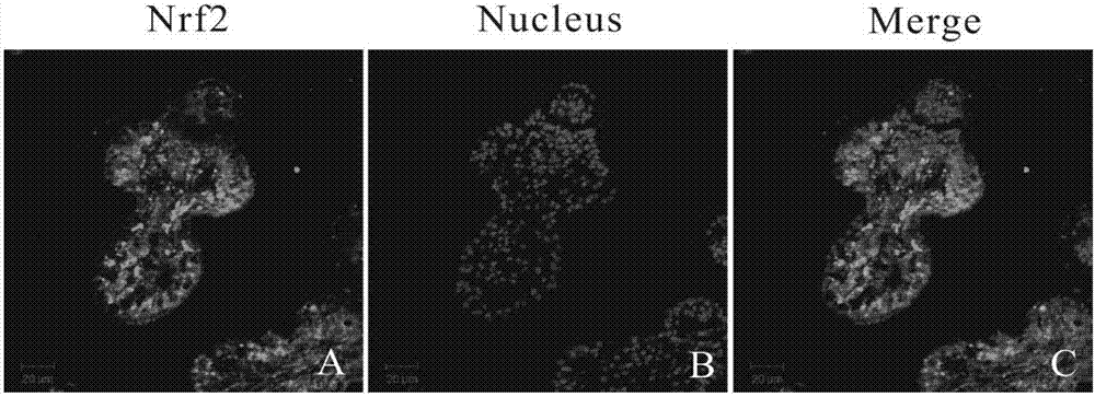 Application of gynesine in preparing drug for in vitro treating echinococcosis granulosa