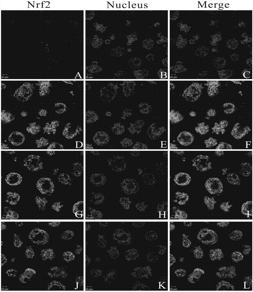 Application of gynesine in preparing drug for in vitro treating echinococcosis granulosa