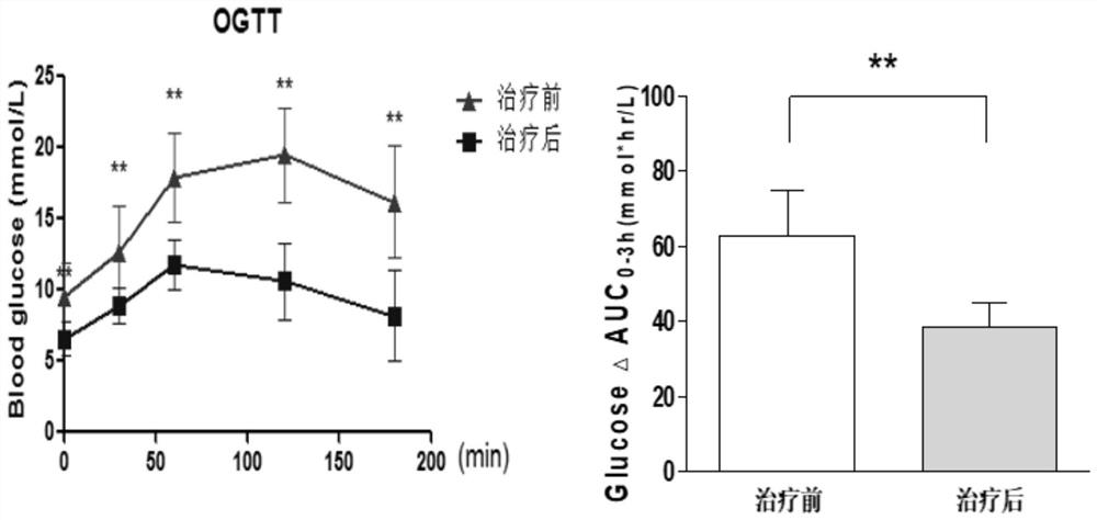 Traditional Chinese medicine composition and application thereof in preparing medicines for preventing and/or treating diabetes mellitus