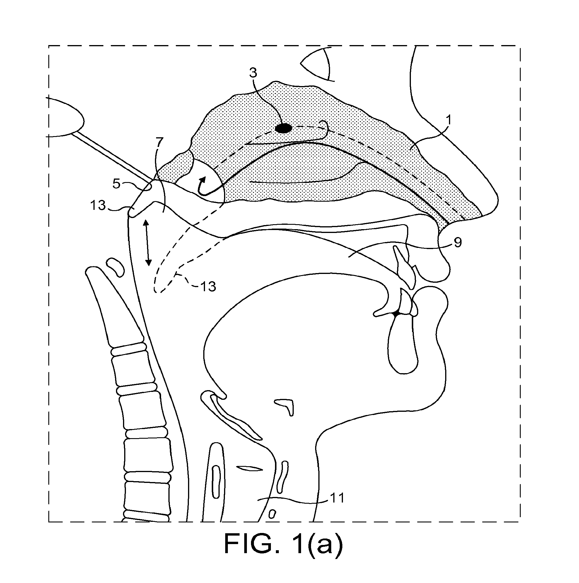 Nasal delivery