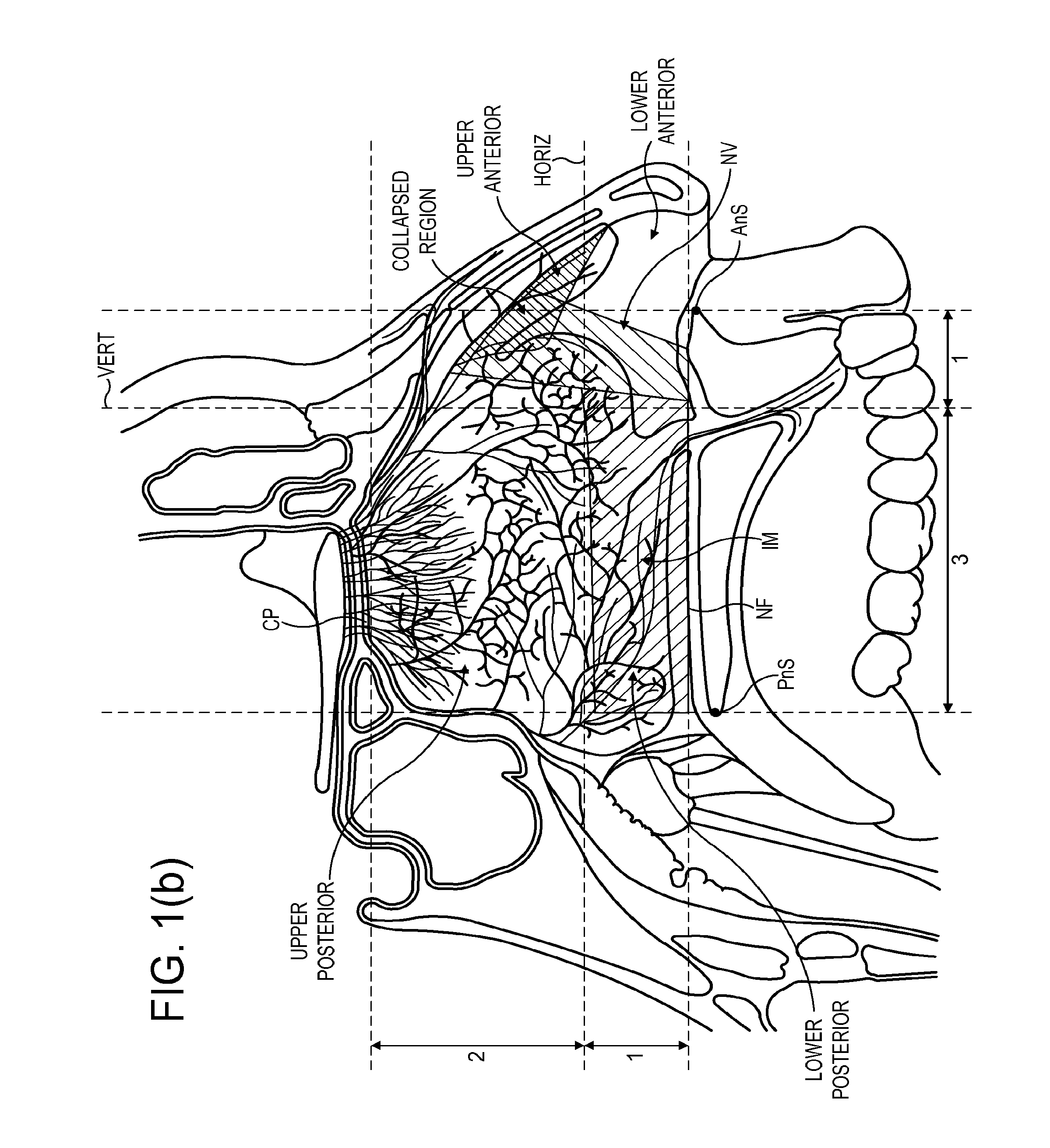 Nasal delivery