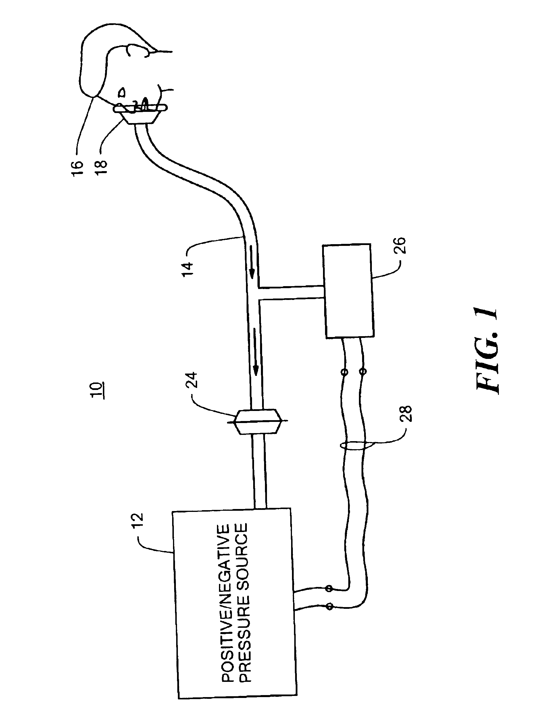 Insufflation-exsufflation system for removal of broncho-pulmonary secretions with automatic triggering of inhalation phase