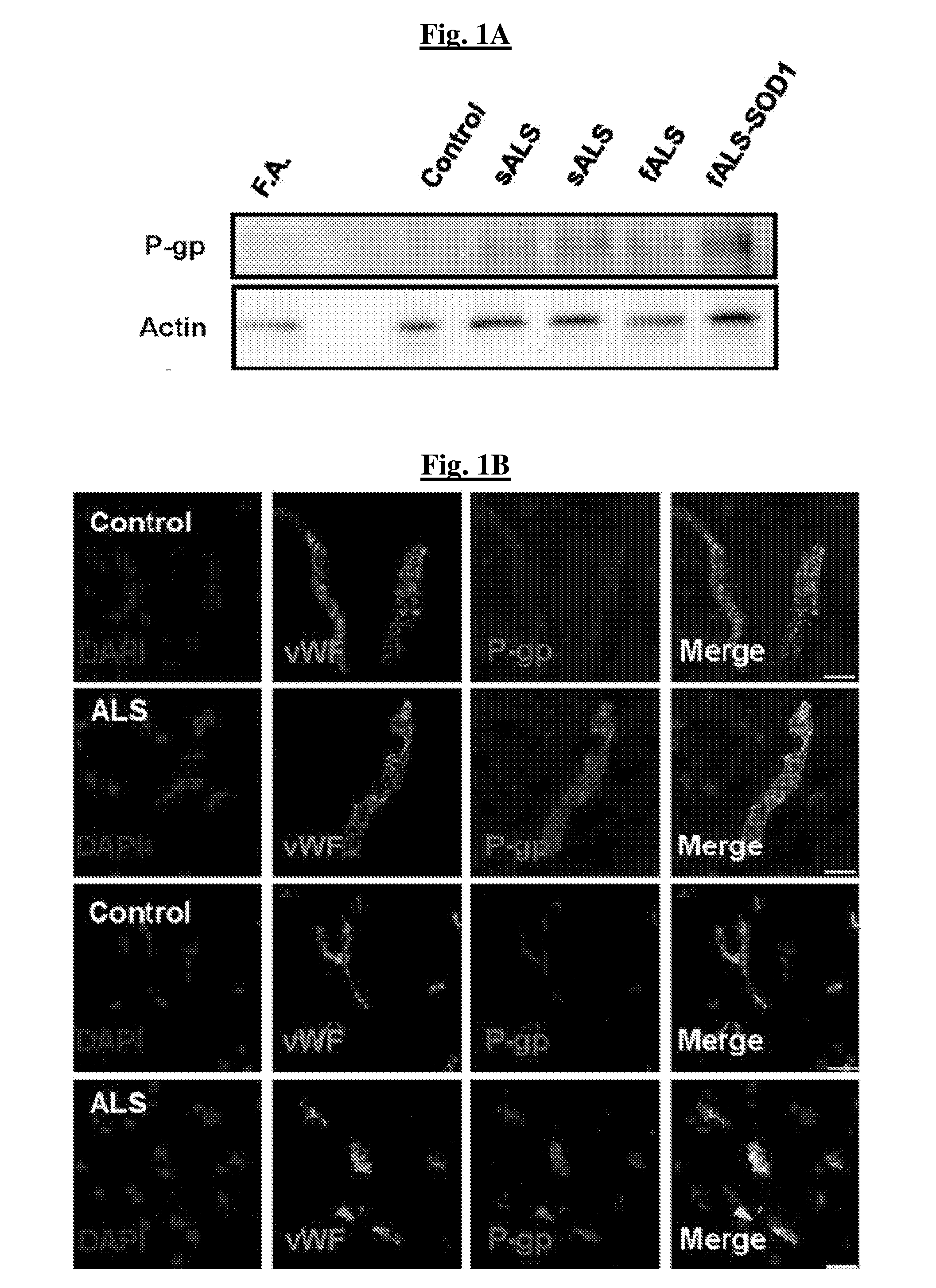 Novel methods of treating a neurodegenerative disease in a mammal in need thereof