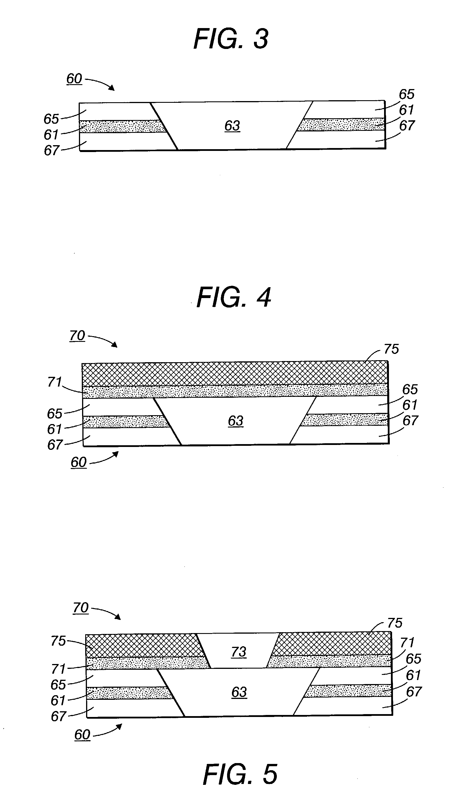 Standoff/mask structure for electrical interconnect